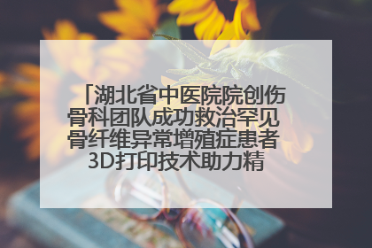 湖北省中医院院创伤骨科团队成功救治罕见骨纤维异常增殖症患者 3D打印技术助力精准矫形手术