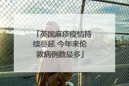 英国麻疹疫情持续蔓延 今年来伦敦病例数最多